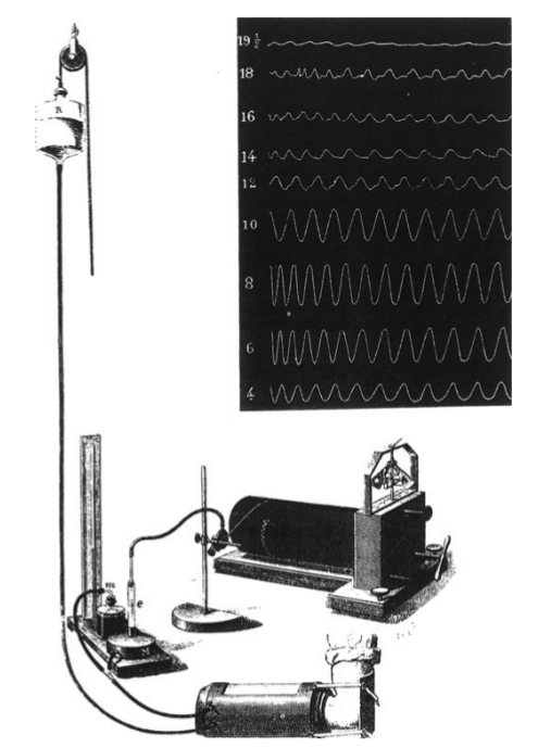 Ancestor of sphygmomanometer